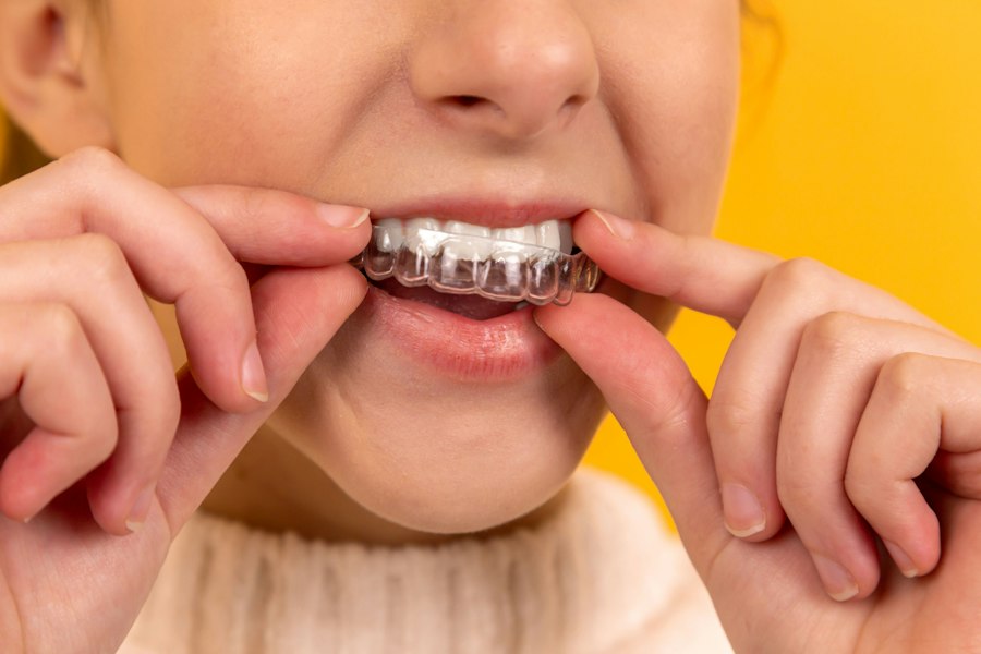 لایت کیور هوشمند VV DENTAL LV-3